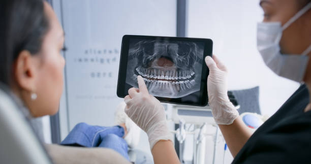 Licensed Wisdom Tooth Removal service in Shenandoah, TX - Dentist Open Now